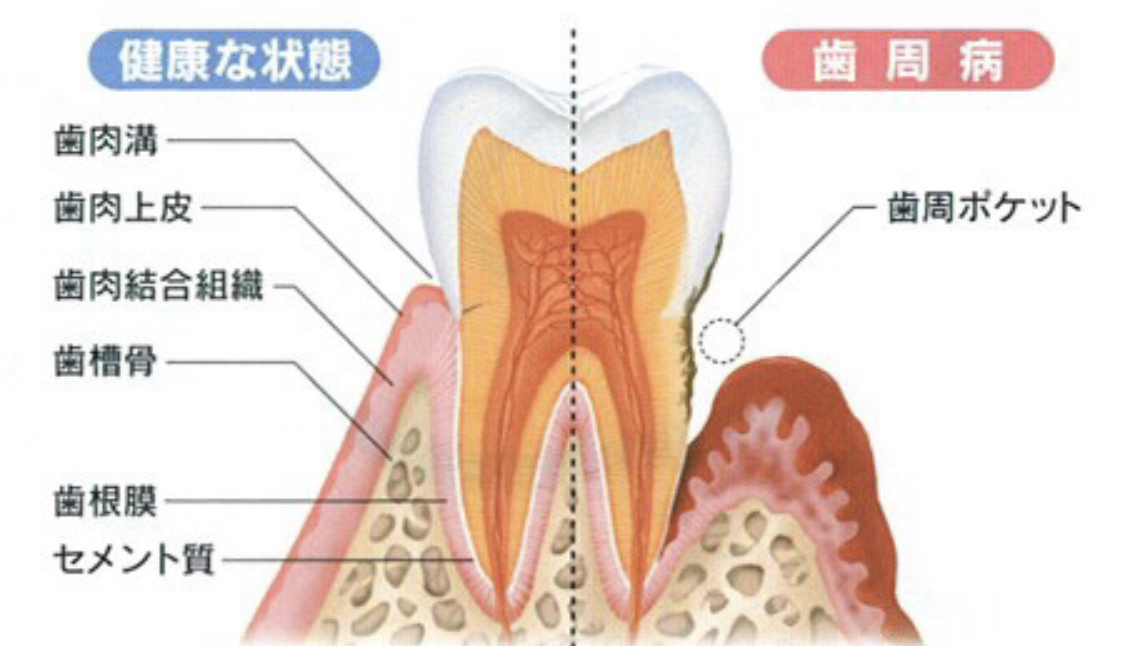 歯 と 骨 の 違い